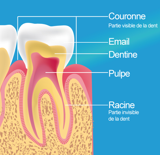 Plombage dentaire, endodontie à Béjaïa - Diamond Dental Center
